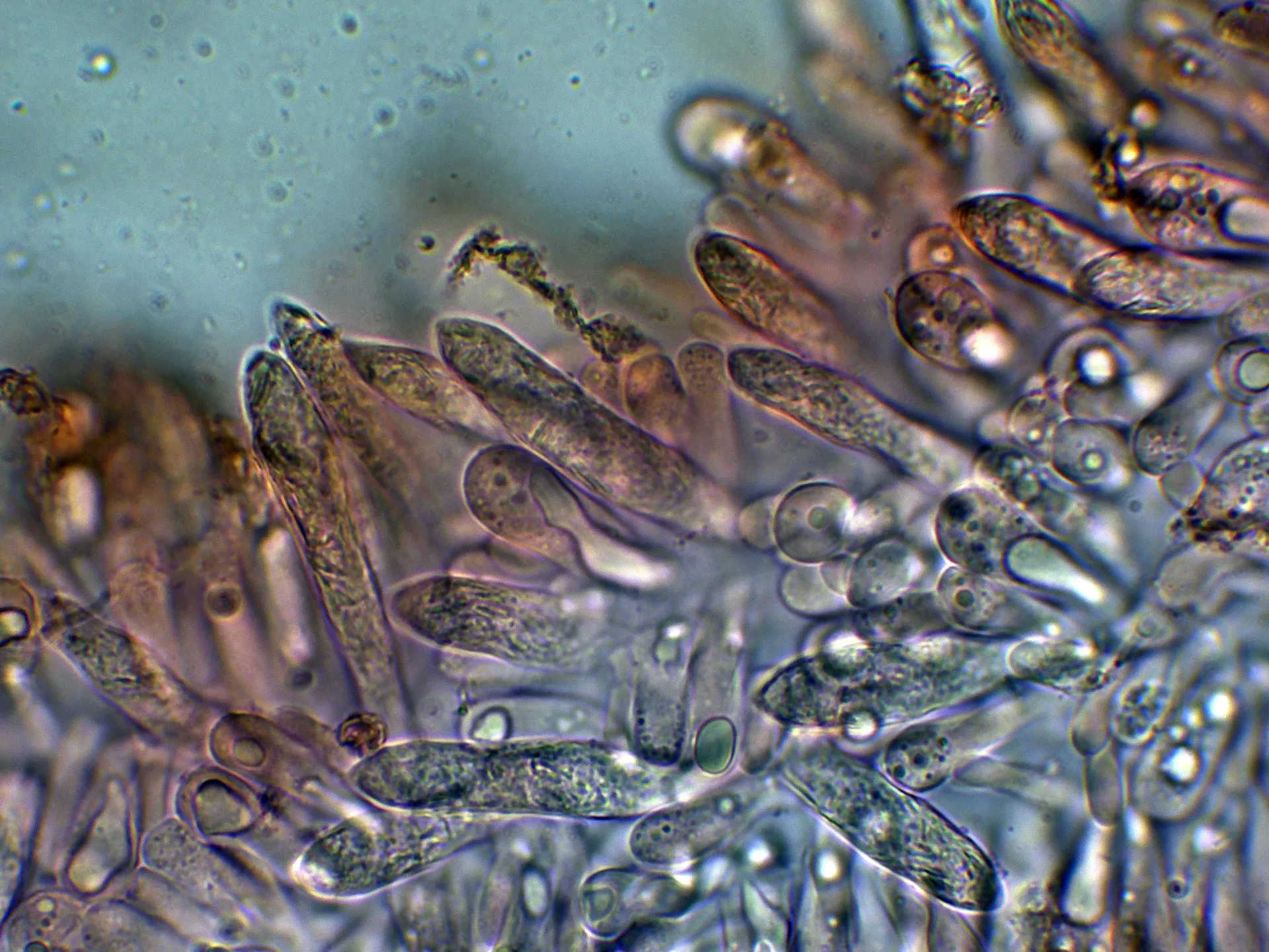 Microscopía de Russula ochroleuca - 10 - Cistidios-001